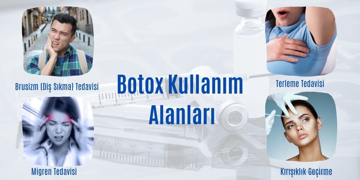 Botox Uygulaması Nedir? Botox Kullanım Alanları Nelerdir?